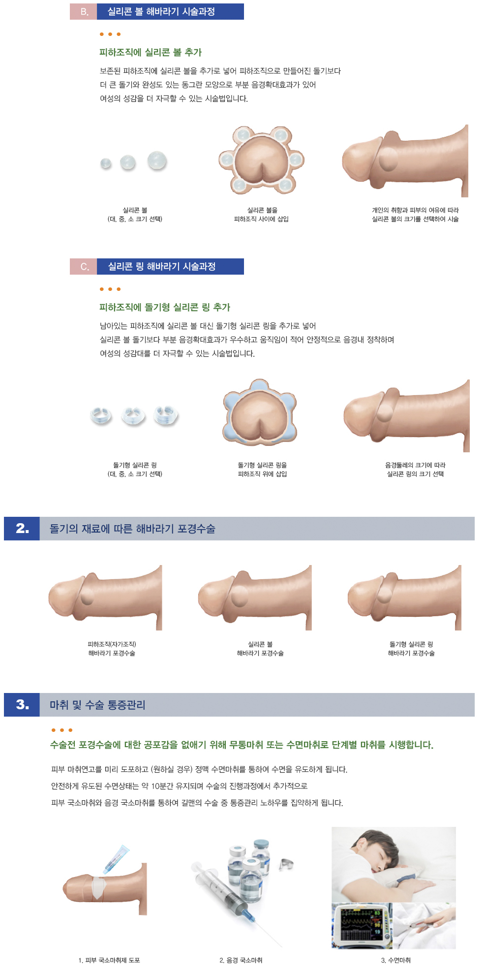 해바라기포경수술 | 길맨